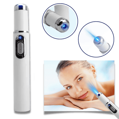 Blue Laser Pen for Effective Dark Spot Removal