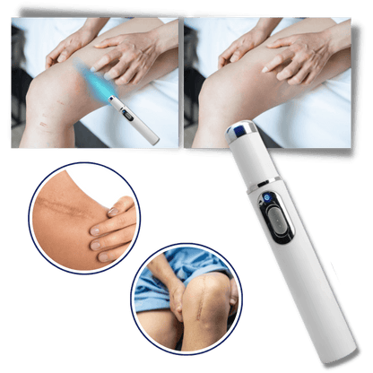 Blue Laser Pen for Effective Dark Spot Removal