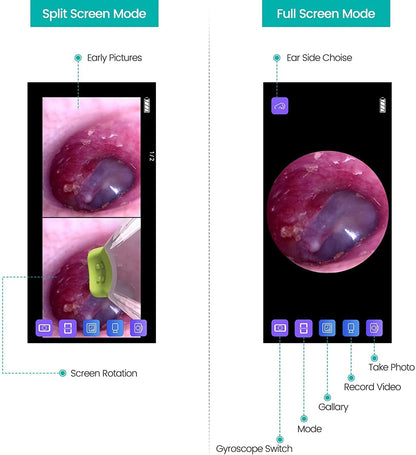 Ear Camera Endoscope - Digital Inspection Tool for Android and iPhone