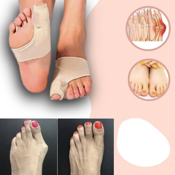 Orthopedic Bunion Corrector for Comfortable Toe Alignment