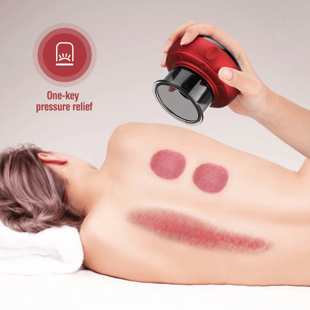 Smart Vacuum Cupping Device for Effective Muscle Relief and Relaxation