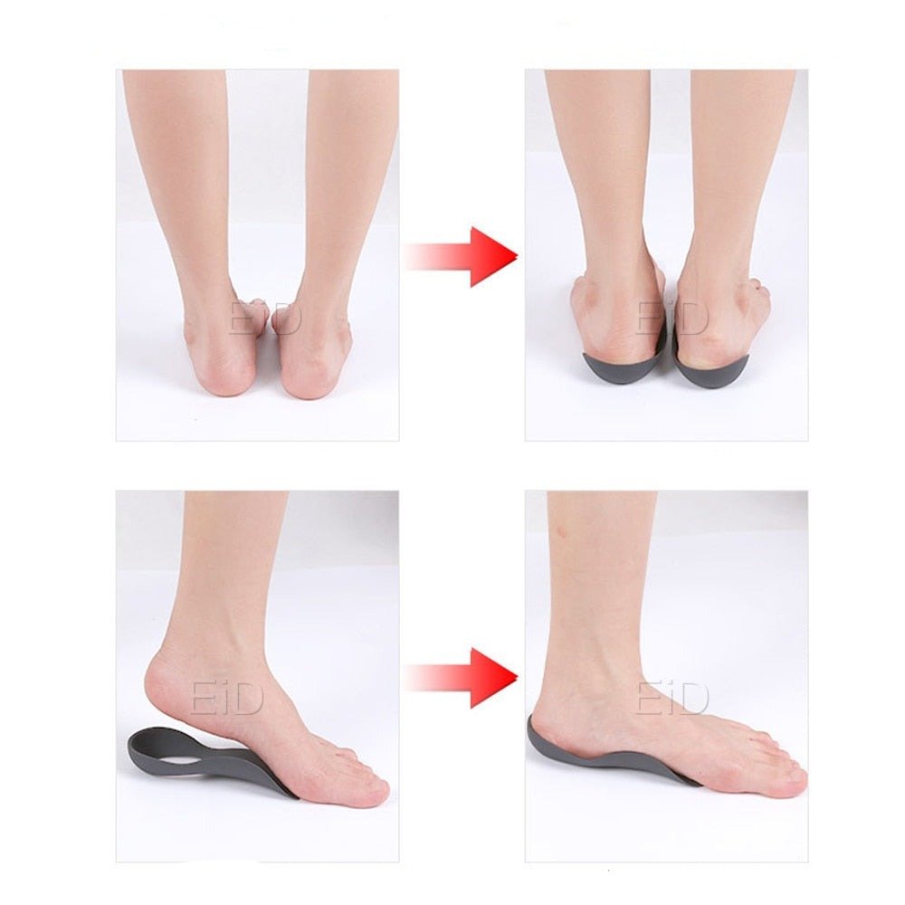 Orthopedic Insoles for Arch Support and Foot Pain Relief