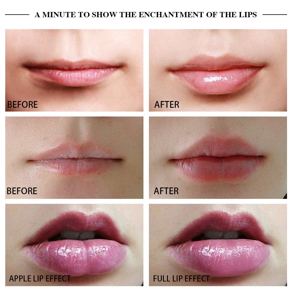 Luscious Lips Handheld Plumping Device for Fuller Smile